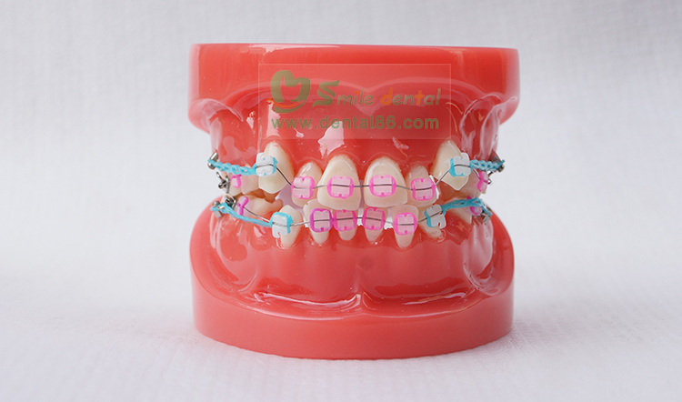 TM-B1-03 Orthodontic Model